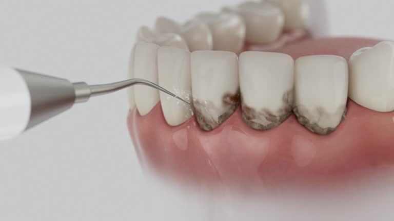 Trusted Dental Crowns And Bridges service in Luverne, AL - Dentist Open Now